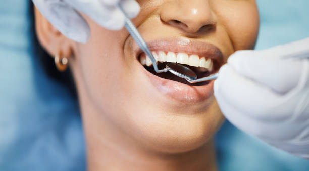 Best Emergency Dental Extractions in Seneca, IL