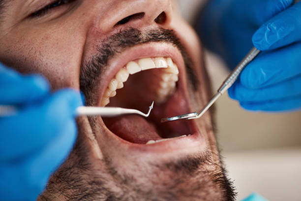 Best Weekend Emergency Dentist in Seneca, IL